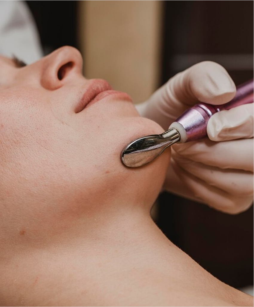 Deep Scar Remodeling & Skin Tightening — Morpheus8 RF Microneedling