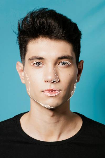 The Precision of “Whole Face Optimization”: the Evolving Standard of the Modern Aesthetics Clinic